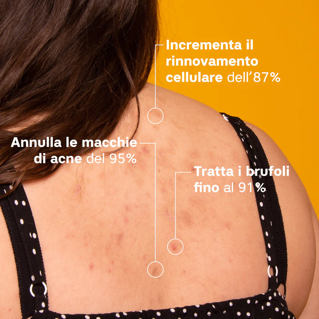 Brufostop Body - Image 4