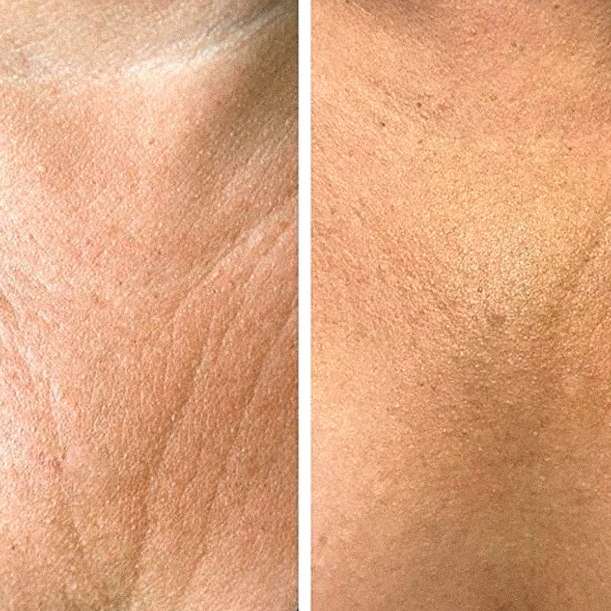 Crema Anti Rughe Décolleté - Image 5