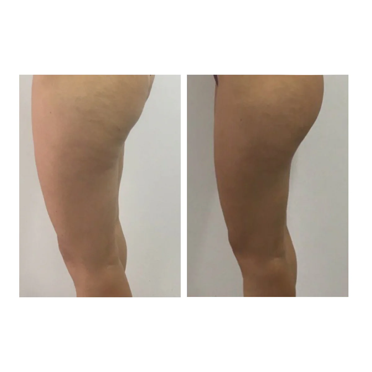 Crema Corpo Rassodante - Image 4