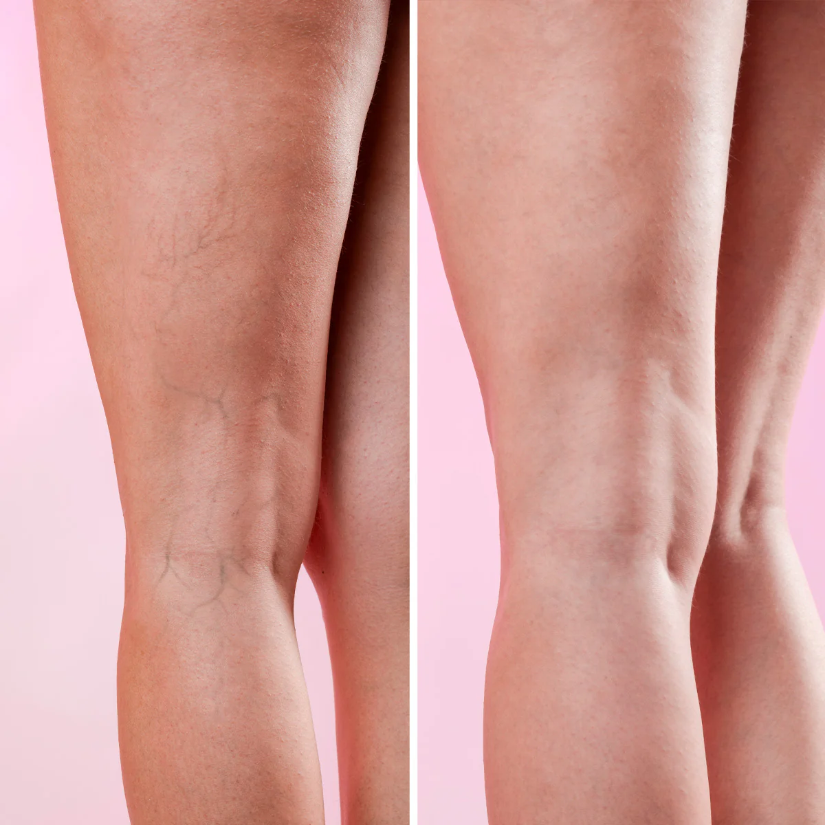 GoLegs - Image 7