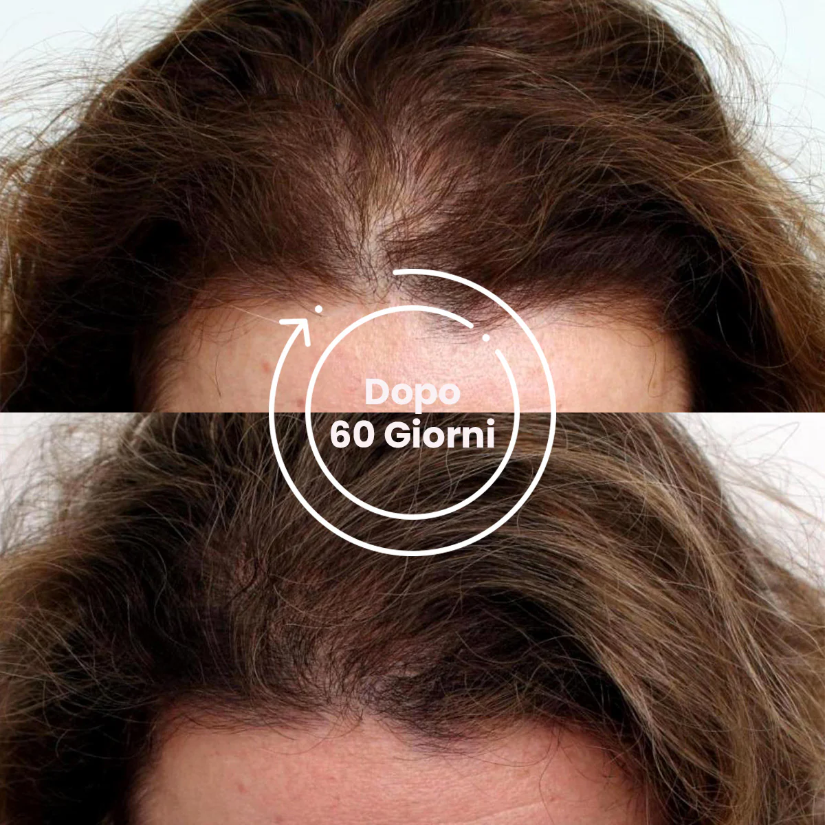 Hair Density Filler - Image 5
