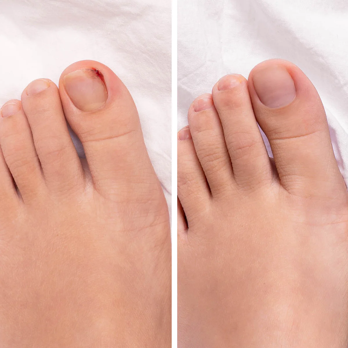 Nail Cure - Image 5