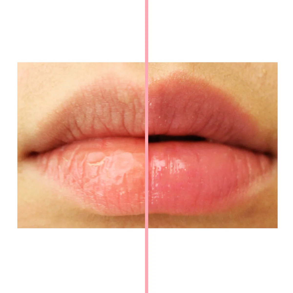 Ultra Lip Mask - Image 5